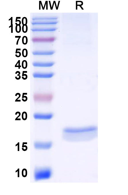 SDS-PAGE for Anti-Human CXCL11/I-TAC Nanobody (11A7)