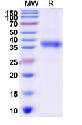 Recombinant Human AURKA Protein, N-His