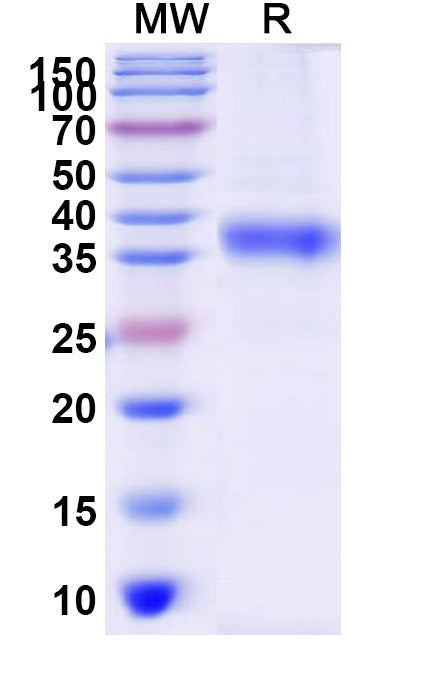 Recombinant Human AURKA Protein, N-His