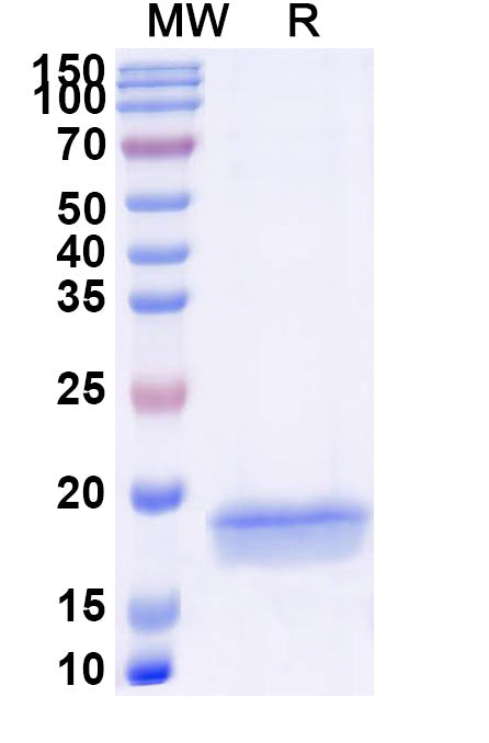 SDS-PAGE for Anti-Human AURKA Nanobody (SAA1200)