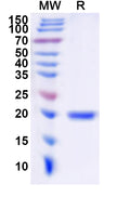 Recombinant Human UBE2C Protein, N-His