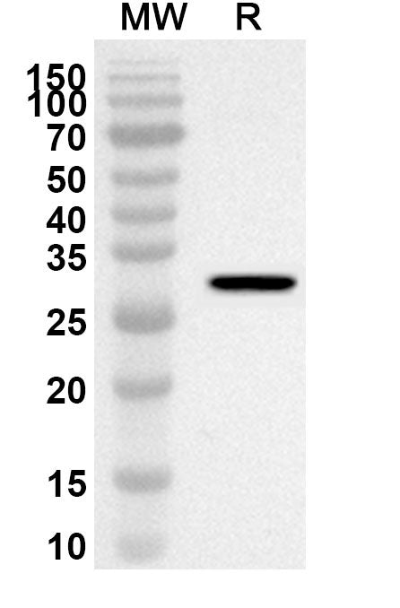 Western blot analysis was performed using anti-ADAM20 polyclonal antibody at 1ug/mL on recombinant ADAM20 (Catalog No. HT412012).