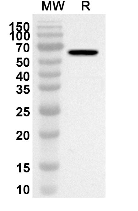 Western blot analysis was performed using anti-DRP1/DNM1L polyclonal antibody at 1ug/mL on recombinant DRP1/DNM1L (Catalog No. HT429012).