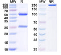 SDS-PAGE for Anti-BIN1/Amphiphysin-II Antibody (N481/113)