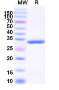 Recombinant Human CD254/RANKL/TNFSF11 Protein, N-His