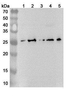 Western blot analysis was performed using anti-RANKL  polyclonal antibody at RANKL  on various samples.
Lane 1: HUVEC cell lysate
Lane 2: RAW264.7 cell lysate
Lane 3: Raji cell lysate
Lane 4: Mouse spleen lysate
Lane 5: Mouse liver lysate