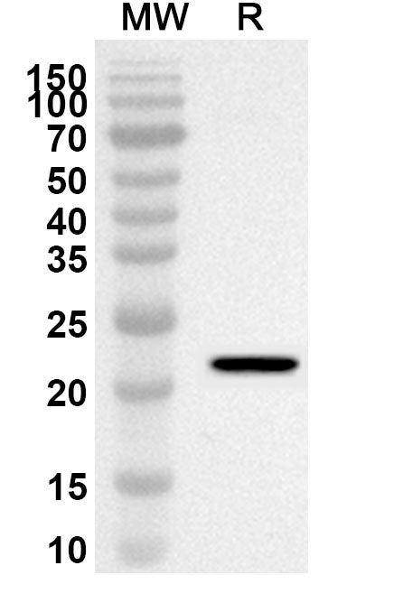 Western blot analysis was performed using anti-MYL12B polyclonal antibody at 1ug/mL on recombinant MYL12B (Catalog No. HT452012).