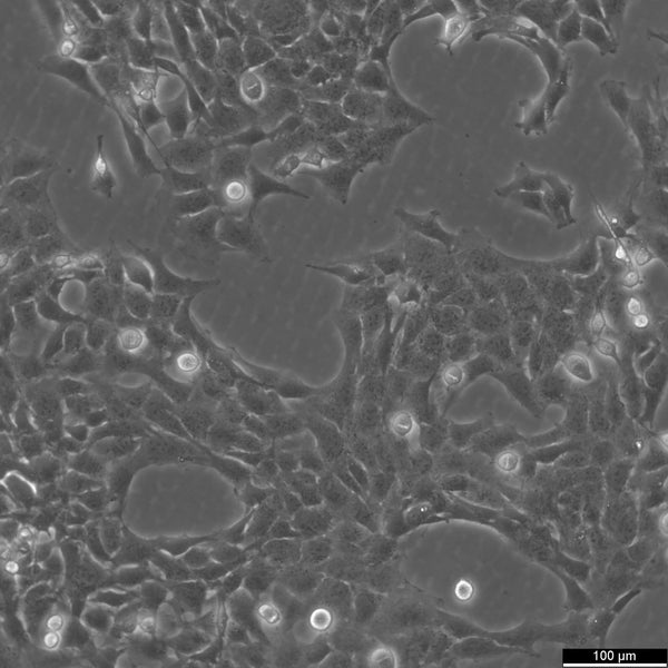 HTR-8/SVneo cell