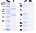 SDS-PAGE for Anti-Human NLRP3 Antibody (18#)