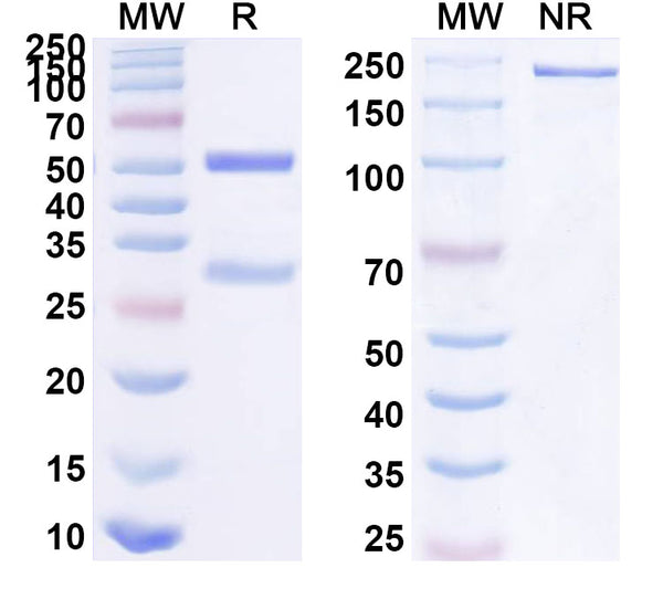 SDS-PAGE for Anti-Human NLRP3 Antibody (18#)