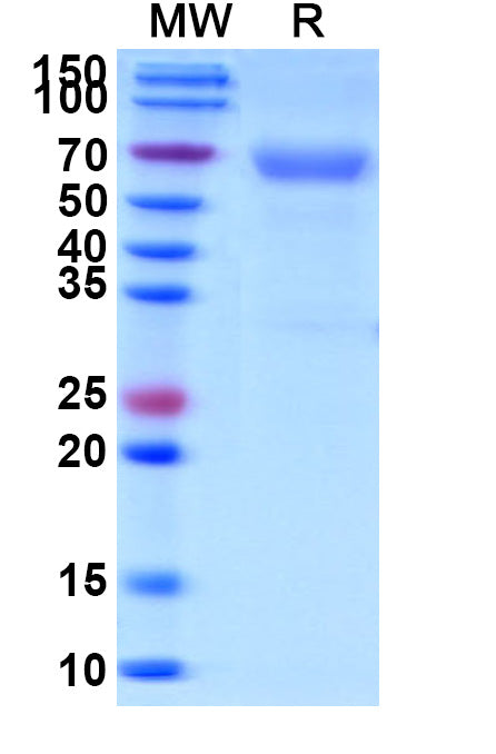 Recombinant Human CD320 Protein, C-Fc
