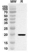 Western blot analysis was performed using anti-CD299/CLEC4M polyclonal antibody at 1ug/mL on recombinant CD299/CLEC4M (Catalog No. HV022012).