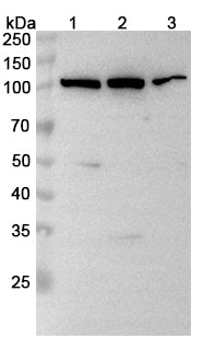 Western blot analysis was performed using anti-ABCB6 polyclonal antibody at 1μg/ml on various samples.
Lane 1: Hela cell lysate
Lane 2: HepG2 cell lysate
Lane 3: HL60 cell lysate