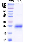 SDS-PAGE for Anti-Human CD366/HAVCR2/TIM-3 Nanobody (SAA1348)