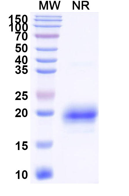 SDS-PAGE for Anti-Human CD366/HAVCR2/TIM-3 Nanobody (SAA1348)
