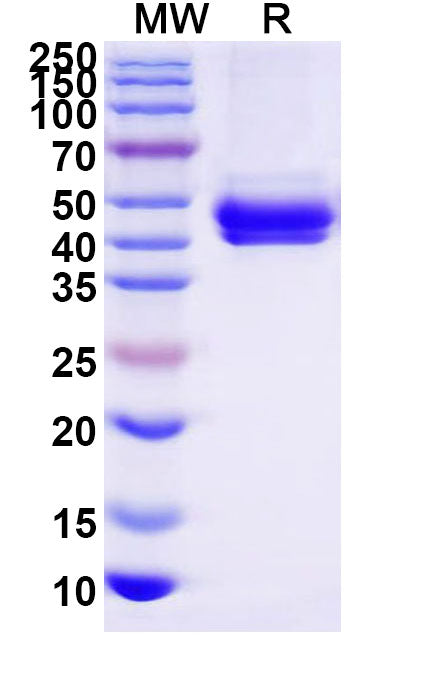 Recombinant Human IgE Fc Fragment, C-His
