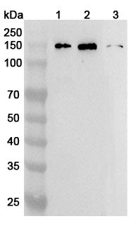 Western blot analysis was performed using anti-MYPN polyclonal antibody at 1ug/mL on various samples.
Lane 1: Mouse heart lysate
Lane 2: Mouse skeletal muscle lysate
Lane 3: Rat skeletal muscle lysate