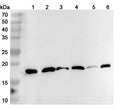 Western blot analysis was performed using anti-CFL2 polyclonal antibody at 1ug/mL  on various samples.
Lane 1: Raji cell lysate
Lane 2: Mouse brain lysate
Lane 3: Mouse lung lysate
Lane 4: Rat brain lysate
Lane 5: Rat lung lysate
Lane 6: Rat skeletal muscle lysate