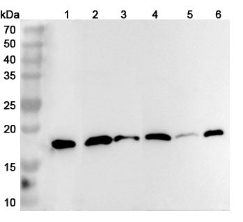 Western blot analysis was performed using anti-CFL2 polyclonal antibody at 1ug/mL  on various samples.
Lane 1: Raji cell lysate
Lane 2: Mouse brain lysate
Lane 3: Mouse lung lysate
Lane 4: Rat brain lysate
Lane 5: Rat lung lysate
Lane 6: Rat skeletal muscle lysate