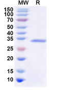 Recombinant Human CD360/IL21R Protein, N-His