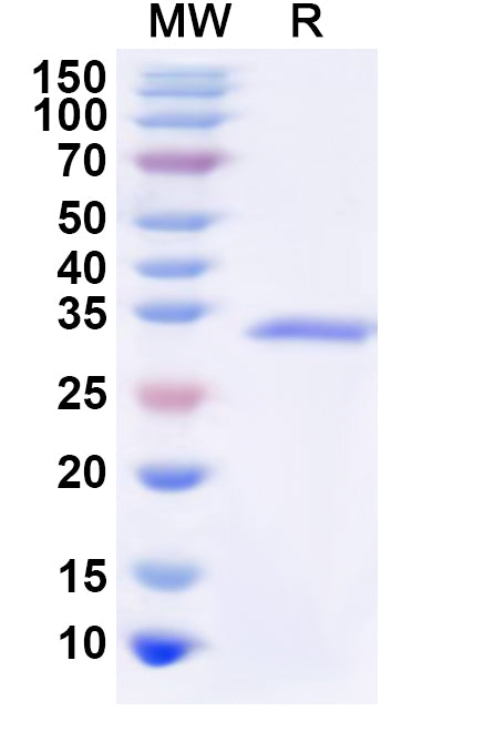 Recombinant Human CD360/IL21R Protein, N-His