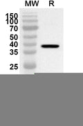 Western blot analysis was performed using anti-PCSK5 polyclonal antibody at 1ug/mL on recombinant PCSK5 (Catalog No. HV084012).