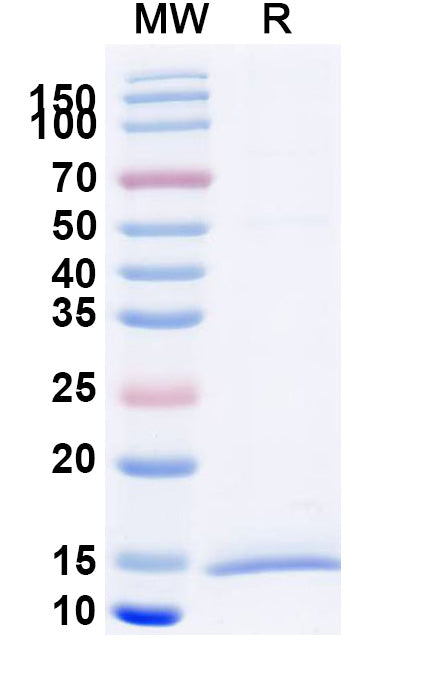SDS-PAGE for Anti-Human BAIAP2 Nanobody (SAA1334)