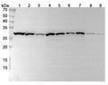 Hela cells were fixed with 4% paraformaldehyde for 20 minutes, followed by blocking with 5% goat serum for 1 hour. The cells were then incubated with a primary antibody targeting CACYBP (HV095014) at a concentration of 14.4 ug/ml overnight at 4°C. Afterward, the cells were incubated with a secondary antibody, Goat Anti-Rabbit IgG (Alexa Fluor-488) for 50 minutes at room temperature. The localization of CACYBP was visualized (shown in green), and nuclear DNA was stained with DAPI (shown in blue).