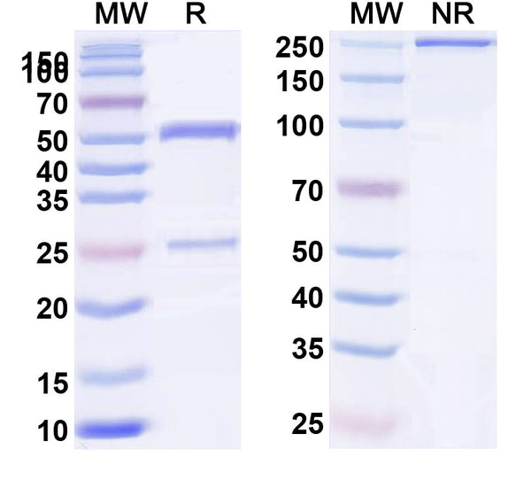 SDS-PAGE for Anti-Human USP7 IP Antibody (SAA0238)