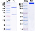 SDS-PAGE for Anti-Human IL22RA2 Antibody (SAA1611)