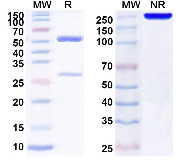 SDS-PAGE for Anti-Human IL22RA2 Antibody (SAA1611)