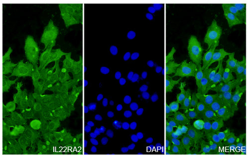 HepG2 cells were fixed with 4% paraformaldehyde for 20 minutes, followed by blocking with 5% goat serum for 1 hour. The cells were then incubated with a primary antibody targeting IL22RA2 (HV100014) at a concentration of 29.2 ug/ml overnight at 4°C. Afterward, the cells were incubated with a secondary antibody, Goat Anti-Rabbit IgG (Alexa Fluor-488) for 50 minutes at room temperature. The localization of IL22RA2 was visualized (shown in green), and nuclear DNA was stained with DAPI (shown in blue).