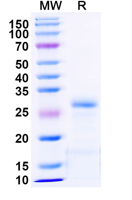Recombinant Human MBD1 Protein, N-His