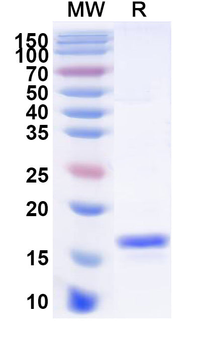 SDS-PAGE for Anti-Human ANGPT4 Nanobody (SAA1257)