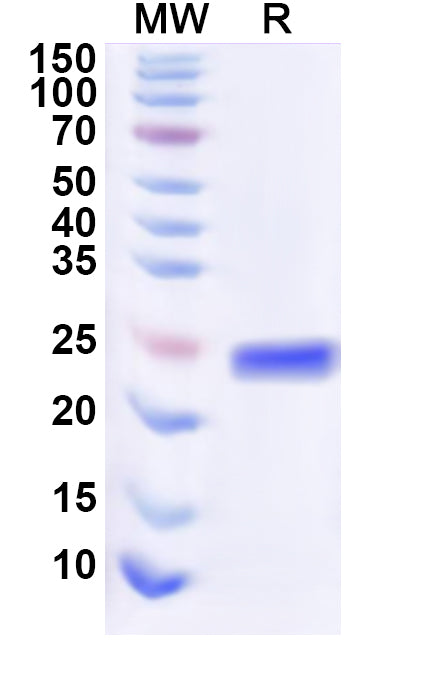 Recombinant Human CD367/CLEC4A Protein, N-His