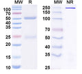 SDS-PAGE for Anti-Human ACE2 Antibody (SAA0323)