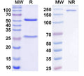 SDS-PAGE for Anti-ACE2 Monoclonal antibody (1A429)