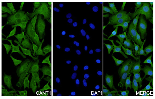 Hela cells were fixed with 4% paraformaldehyde for 20 minutes, followed by blocking with 5% goat serum for 1 hour. The cells were then incubated with a primary antibody targeting CANT1 (HV161014) at a concentration of 26 ug/ml overnight at 4°C. Afterward, the cells were incubated with a secondary antibody, Goat Anti-Rabbit IgG (Alexa Fluor-488) for 50 minutes at room temperature. The localization of CANT1 was visualized (shown in green), and nuclear DNA was stained with DAPI (shown in blue).
