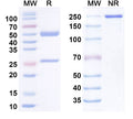 Anti-Human TERM2 Reference Antibody (PY314) – Figure 1 of 1