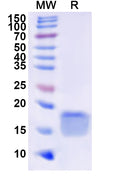 Recombinant Human NOX1 Protein, N-His