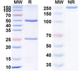 Anti-Human SOST/Sclerostin Reference Antibody (Setrusumab) – Figure 1 of 2