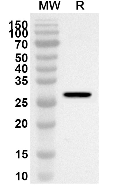 Western blot analysis was performed using anti-Human MMP25 polyclonal antibody at 1ug/mL on recombinant Human MMP25 (Catalog No. HV202012).