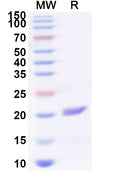 Recombinant Human CD300LF Protein, N-His