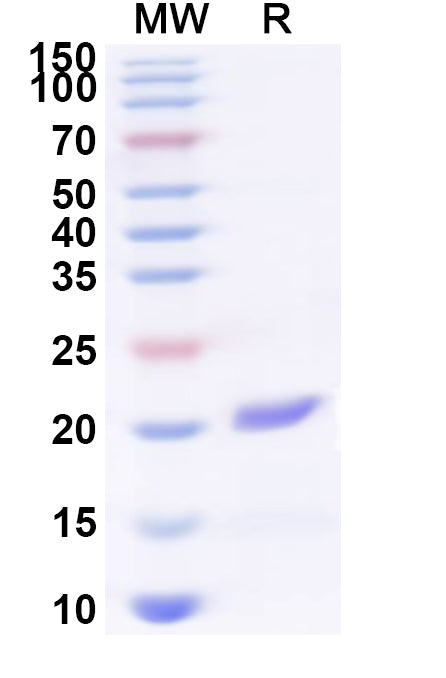 Recombinant Human CD300LF Protein, N-His