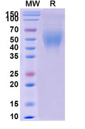 Recombinant Human CD200R1/OX2R Protein, C-His