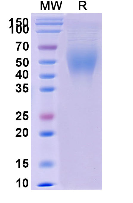 Recombinant Human CD200R1/OX2R Protein, C-His