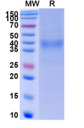 Recombinant Human CD158d/KIR2DL4 Protein, C-His