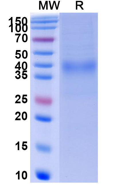 Recombinant Human CD158d/KIR2DL4 Protein, C-His
