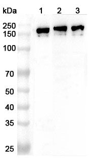 Western blot analysis was performed using anti-PLCB1 polyclonal antibody at 1ug/mL  on various samples.
Lane 1: Mouse brain lysate
Lane 2: Rat brain lysate
Lane 3: Rat cerebellum lysate