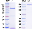 SDS-PAGE for Anti-GABA(A)R, Beta1 Antibody (N96/55)
